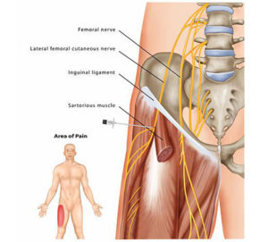 Peripheral Nerve Block - Pain management clinics in Las