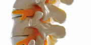 Cervical Thoracic and Lumbar Injections Cervical Thoracic and Lumbar Injections