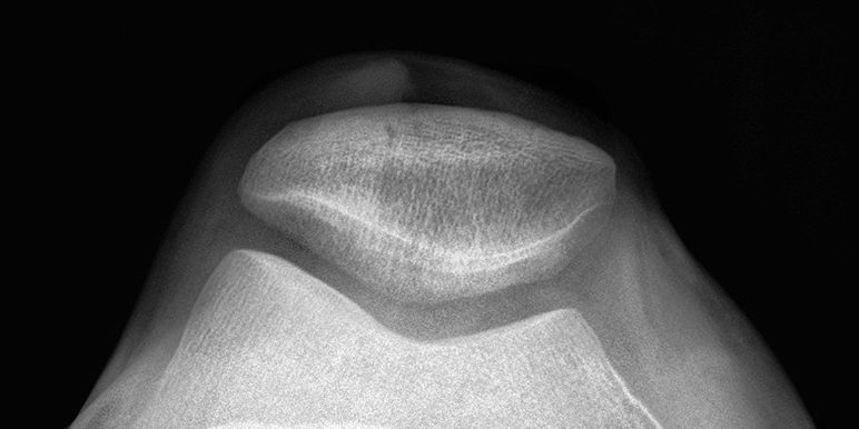 knee-pain 5 Treatments For Knee Pain | NVCPC.com