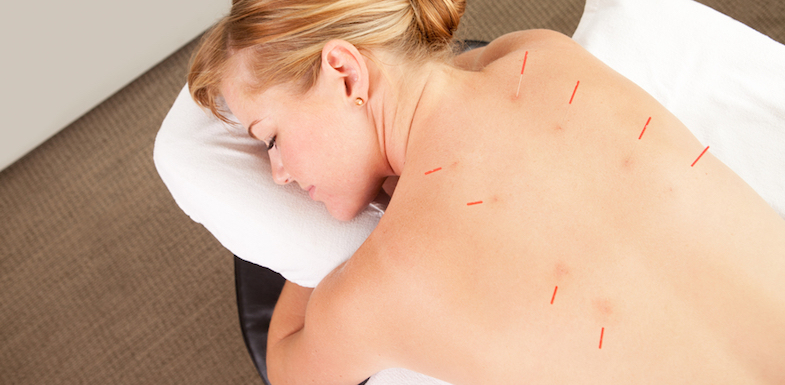 Top 5 Benefits Of Acupuncture | NVCPC.com